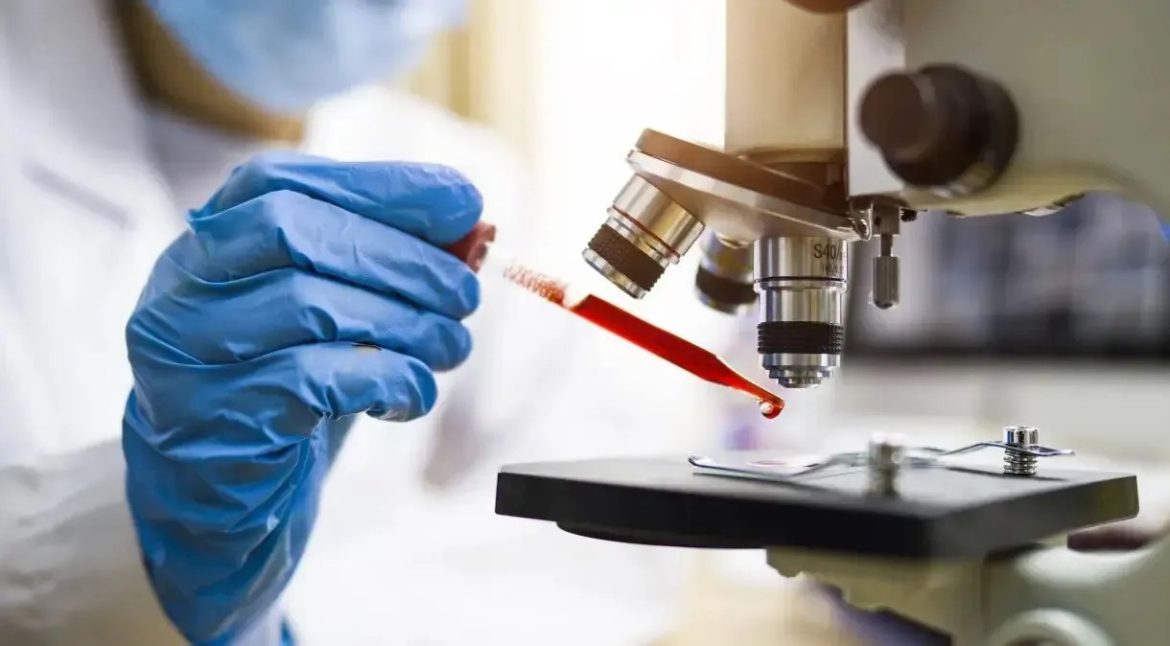 biopsia-liquida-e-novidade-no-cuidado-do-cancer;-veja-como-funciona