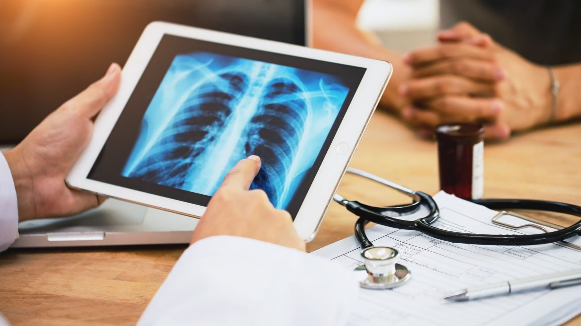 cancer-de-pulmao:-terapia-alvo-reduz-em-84%-risco-de-morte;-veja