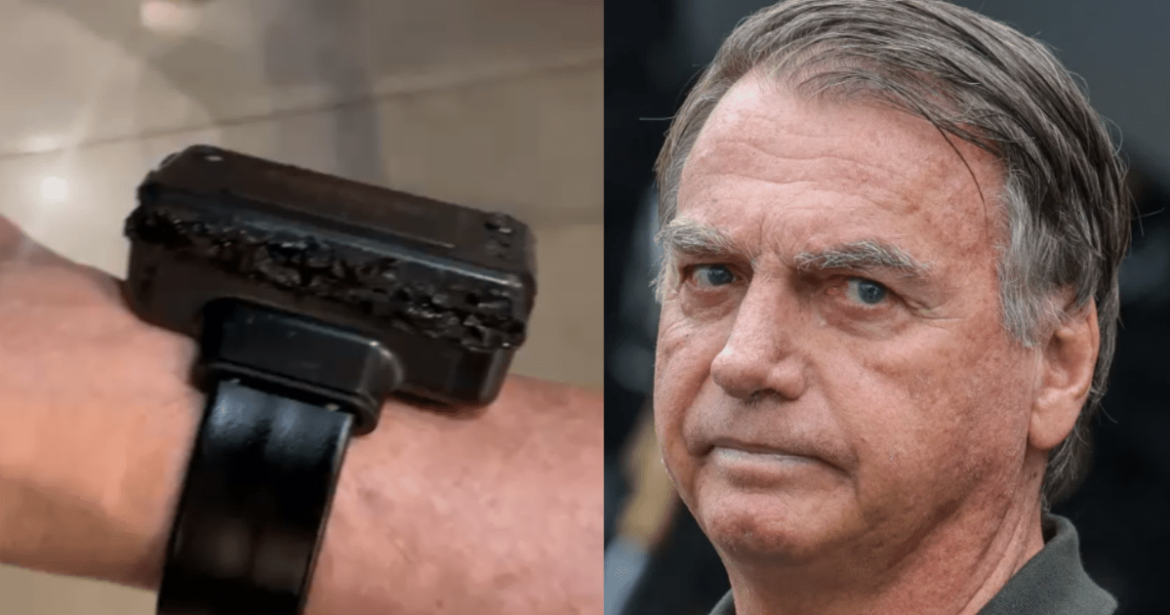 laudo-confirma-violacao-da-tornozeleira-de-bolsonaro-com-fonte-de-calor