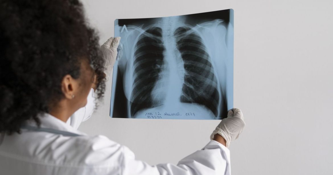 alem-do-tabagismo,-obesidade-e-inflamacao-sao-prejudiciais-aos-pulmoes