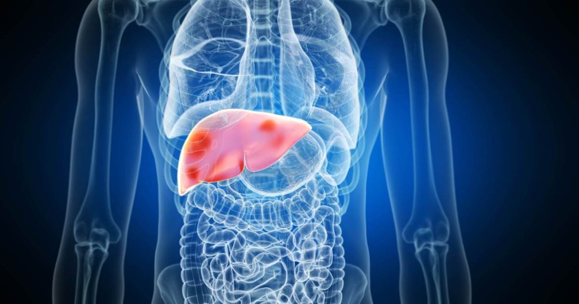dr.-kalil-e-especialistas-explicam-o-que-e-sindrome-metabolica-do-figado