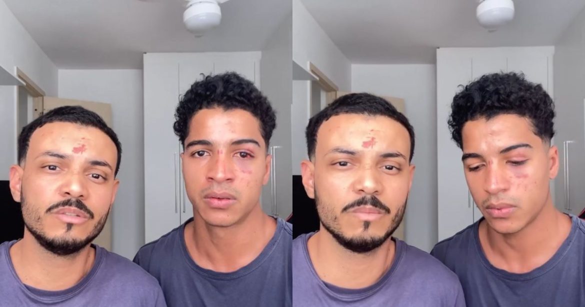jovens-relatam-ataque-homofobico-apos-festa-universitaria-no-rj